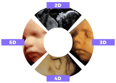 5D Model | Our structured approach