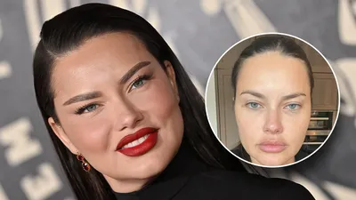 Adriana Lima Hits Back With Surprising Explanation After Fans Wonder If She  Got Plastic Surgery! - Perez Hilton