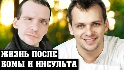 Стало известно, в каком состоянии находится перенесший инсульт Янин - РИА  Новости, 