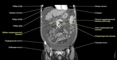 Брюшная и тазовая полости : нормальная анатомия | e-Anatomy