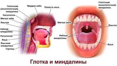 Ангина - причины появления, симптомы заболевания, диагностика и способы  лечения