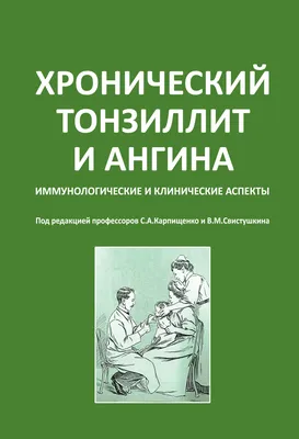 Ангина: разная и коварная — Министерство здравоохранения ПМР