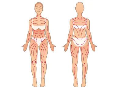 Правильный антицеллюлитный массаж в домашних условиях: правила и особенности