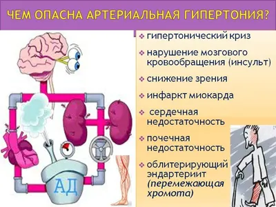 Артериальная гипертензия. Просто о сложном. - Доказательная медицина для  всех