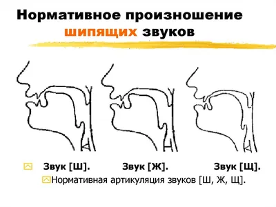 ИСПРАВЛЕНИЕ ШИПЯЩИХ ЗВУКОВ Ш-Ж-Щ | Константин Федосеев | Дзен