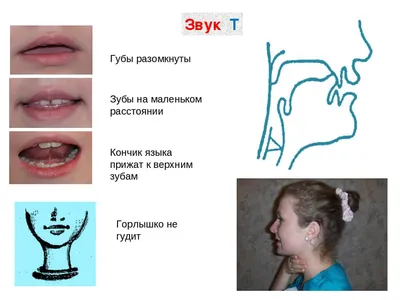 Постановка звука Т | Дефектология Проф