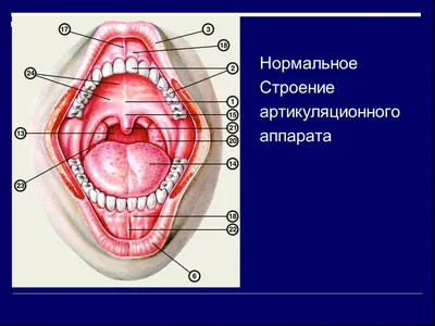 Презентация "Нарушения строения артикуляционного аппарата" по медицине –  скачать проект