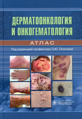 Потекаев Николай Николаевич, Акимов Всеволод Георгиевич. Дифференциальная  диагностика и лечение кожных болезней. Атлас-справочник — купить в  интернет-магазине по низкой цене на Яндекс Маркете