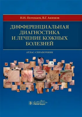 Атлас по дерматологии - купить с доставкой по выгодным ценам в  интернет-магазине OZON (607860056)