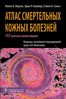 Дифференциальная диагностика в дерматологии. Атлас, Эштон Р.; Леппард Б.,  Купер Х.; Пер с англ.; Под ред. В.В. Владимирова, В.В. Владимировой, Е.В.  Владимировой - Интернет-магазине новинок медицинской литературы