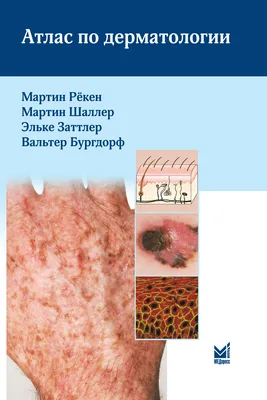 Иллюстрация 7 из 20 для Дифференциальная диагностика в дерматологии. Атлас  - Эштон, Леппард, Купер | Лабиринт - книги.