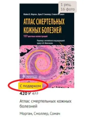 Атлас кожных заболеваний 1912 года: 2 500 грн. - Книги / журналы Харьков на  Olx