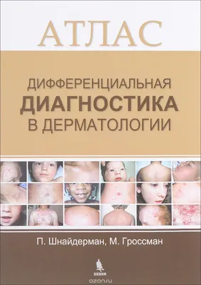 Потекаев Николай Николаевич, Акимов Всеволод Георгиевич. Дифференциальная  диагностика и лечение кожных болезней. Атлас-справочник — купить в  интернет-магазине по низкой цене на Яндекс Маркете