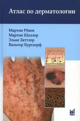 Цветной Атлас Кожных – купить в интернет-магазине OZON по низкой цене