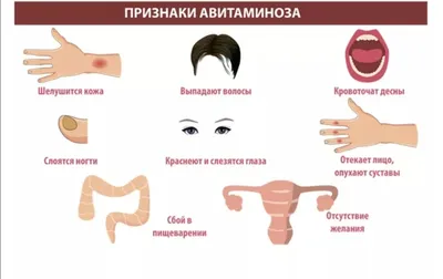 Авитаминоз — ГКП на ПХВ “ГОРОДСКАЯ ПОЛИКЛИНИКА” ПРИ УПРАВЛЕНИИ  ЗДРАВООХРАНЕНИЯ АКМОЛИНСКОЙ ОБЛАСТИ