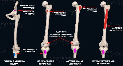 Биомеханика коленного сустава. Статьи