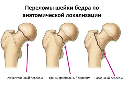 Бедро Бедро Бедро Бедра человека Грудная клетка, мышечная анатомия, рука,  человек, мода Иллюстрация png | PNGWing