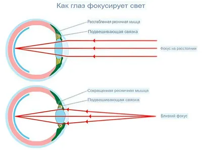 Близорукость или дальнозоркость?