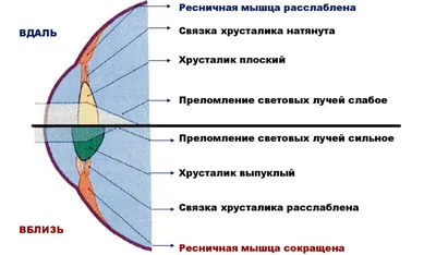 Близорукость, или миопия - причины появления, симптомы заболевания,  диагностика и способы лечения