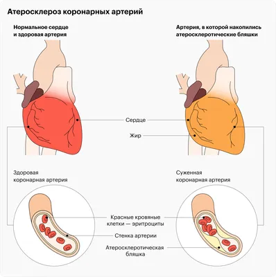 Причины боли в груди