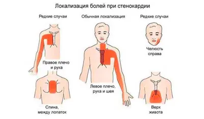 Боль в груди: симптомы, причины и лечение боли в области грудной клетки