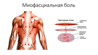 16 болевых точек, удары по которым сразят обидчика - Лайфхакер