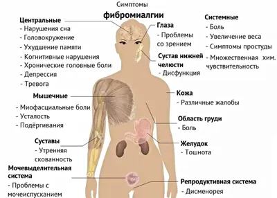 Миофасциальный болевой синдром | Диагностика и лечение боли