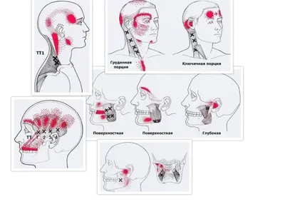 Болевые точки на теле человека | Пикабу