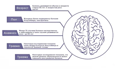 Назван необычный симптом болезни Альцгеймера - РИА Новости, 