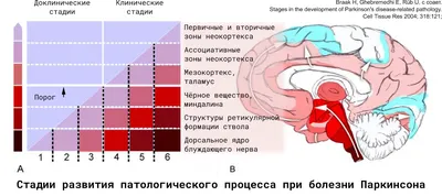 Болезнь Паркинсона, и как с ней бороться – книга, написанная пациентом,  Леонид Шевченко – скачать книгу fb2, epub, pdf на ЛитРес