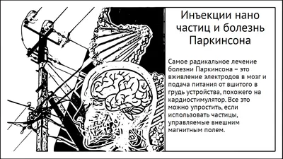 Новые методы лечения болезни Паркинсона, магнит и инъекции m-Torques / Хабр