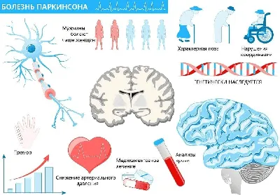 Болезнь Паркинсона: диагностика, уход, упражнения | Эйзлер Аркадий  Кальманович - купить с доставкой по выгодным ценам в интернет-магазине OZON  (497640463)