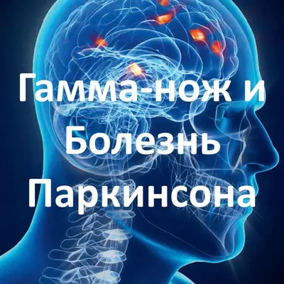 Болезнь Паркинсона: причины, симптомы у мужчин и женщин, признаки, лечение