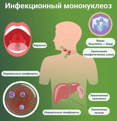 Почему болит горло и нёбо, что делать