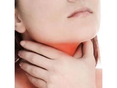 Болит горло после удаления зуба - почему, сколько, что делать