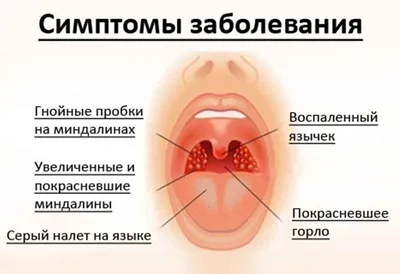 Холодная осень о боли в горле спросит | Щотижневик АПТЕКА