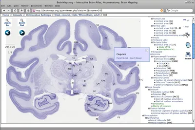 Brain Maps May Reveal the Origins and Paths of Neurological Dysfunction