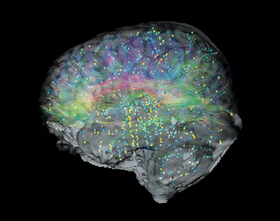 New brain atlas offers comprehensive map of the human brain | MIT  Technology Review