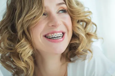 10 причин поставить брекеты во взрослом возрасте – мнение стоматологов