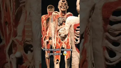 Рука человека в разрезе, анатомия» — создано в Шедевруме
