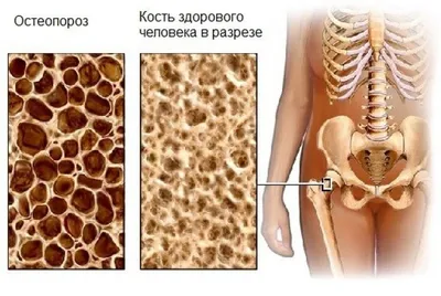 Купить МОДЕЛЬ ПОЧКИ В РАЗРЕЗЕ в Уфе в MediaRB. Цена, характеристики,  фотографии - Медиа РБ Инжиниринг