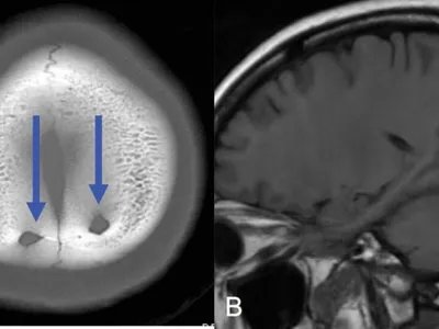 Дидактическая модель черепа на шейном отделе позвоночника, 4 части - 3B  Smart Anatomy - 1020161 - A20/2 - Модели черепа человека - 3B Scientific