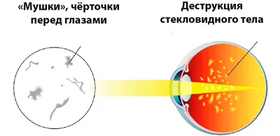 ЧЕРНЫЕ ТОЧКИ/САЛЬНЫЕ НИТИ | OaziS корейская косметика | Дзен