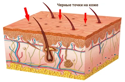 Сальные нити", или, моя жизнь уже не будет прежней | Пикабу