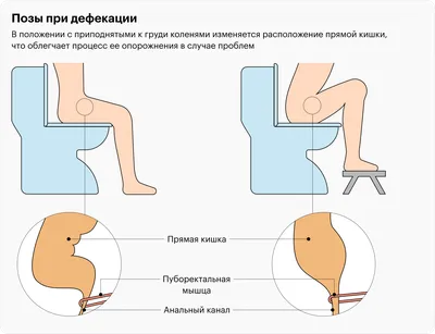 Как правильно какать: дефекация при запорах, регулярный стул, вредно ли  тужиться в туалете