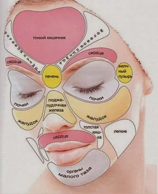 О чем говорят прыщи на лице и теле: карта прыщей и что они означают?
