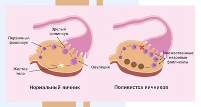 Женское гормональное бесплодие | Полезное от клиники «Геном» в Волгограде