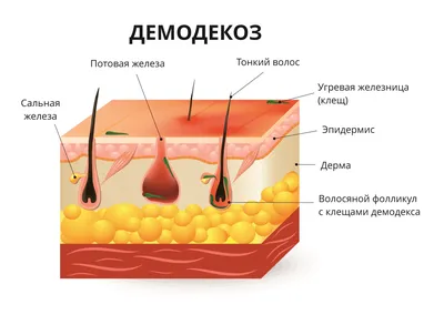 Лечение демодекоза в Киеве | Демодекс (подкожный клещ) лечение | Цена |  Elle Estetick