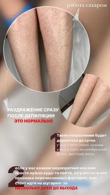 Бьюти фото. Эстетика. Эпиляция | Diy hair wax, Waxing, Waxing tips