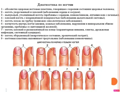 ⚠️КАК ПО НОГТЯМ ОПРЕДЕЛИТЬ ЗАБОЛЕВАНИЕ ОРГАНИЗМА. Что скрывается за  проблемами с ногтями - YouTube